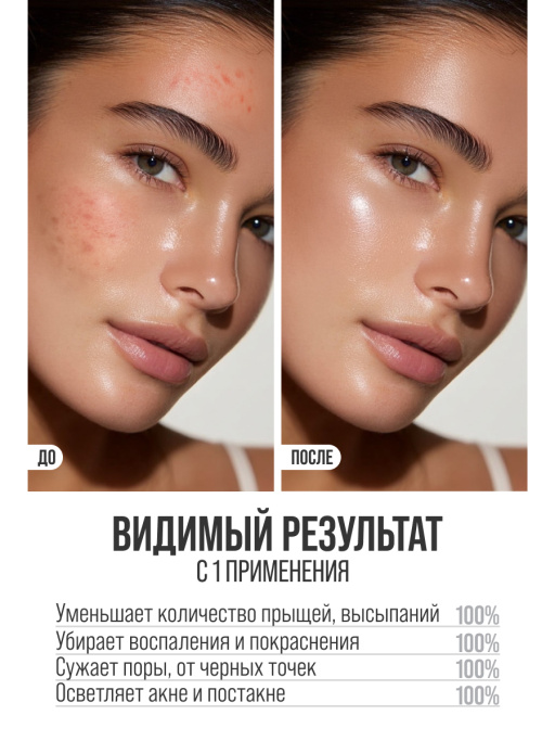 Сыворотка для лица 7DAYS от прыщей B3 2%+ZN 0,5%